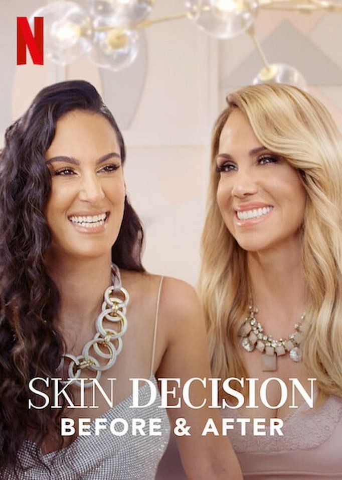 Season 2 of Skin Decision: Before and After poster